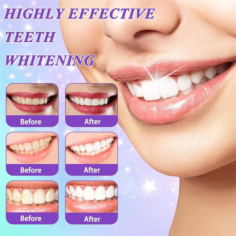 9D Purple Teeth Whitening Toot - Purple Toning Shampoo 评论和价格