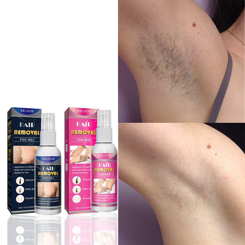 1/2PCS Super Natural Painless  - Hair Care Lotion 评论和价格